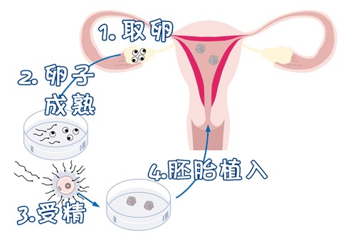 岩墨医疗